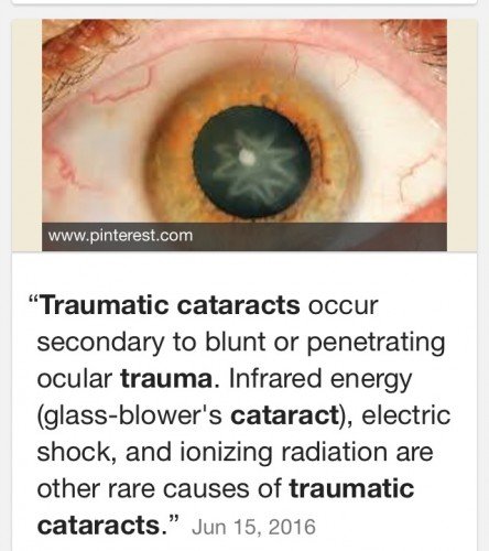 Information on Traumatic Cataract from Google
